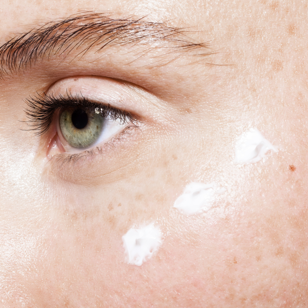 Rosacea Products